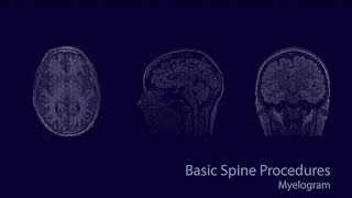 Cases in Radiology Episode 1 neuroradiology CT MRI [upl. by Bouley]