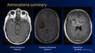 Neuroradiology review  brain gyral anatomy [upl. by Tenneb]