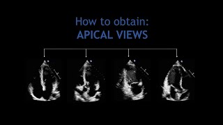 How to obtain APICAL VIEWS Echocardiography [upl. by Haldas]