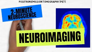 Neuroimaging of Pediatric Disease [upl. by Itnahsa]