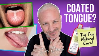 COATED TONGUE Glycerin Remedy  Dr Doug Willen [upl. by Baptist]