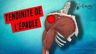 COMPRENDRE LA TENDINITE DE LÉPAULE Explications professionelles [upl. by Nahej473]