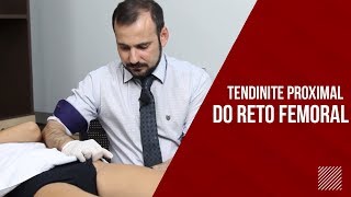 Tendinite Reto Femoral CUIDADO COM A ARTÉRIA [upl. by Nibbor]