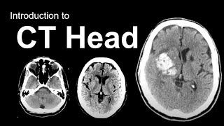 Introducing MRI The Basics 1 of 56 [upl. by Nireil697]