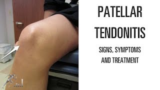 Patellar tendonitis Signs symptoms and remedies for this difficult knee problem [upl. by Drusie934]