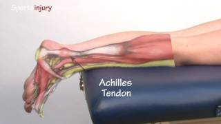 Achilles Tendonitis  Tendinopathy  Explained in 90 Seconds [upl. by Aketal]