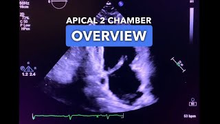 Apical 2 Chamber View  Echocardiography Education [upl. by Burroughs]